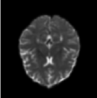 Processed DTI with EPI Correction